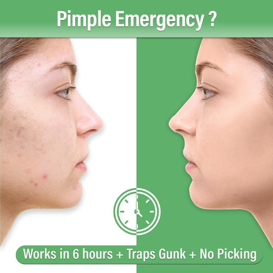 Ecombrella Hydrocolloid Invisible Spot Cover with Salicylic Acid – Absorbing Cover, Hyrocolloid Patch, Korean Skin Care, Facial Stickers, 2 Sizes (72 Count)