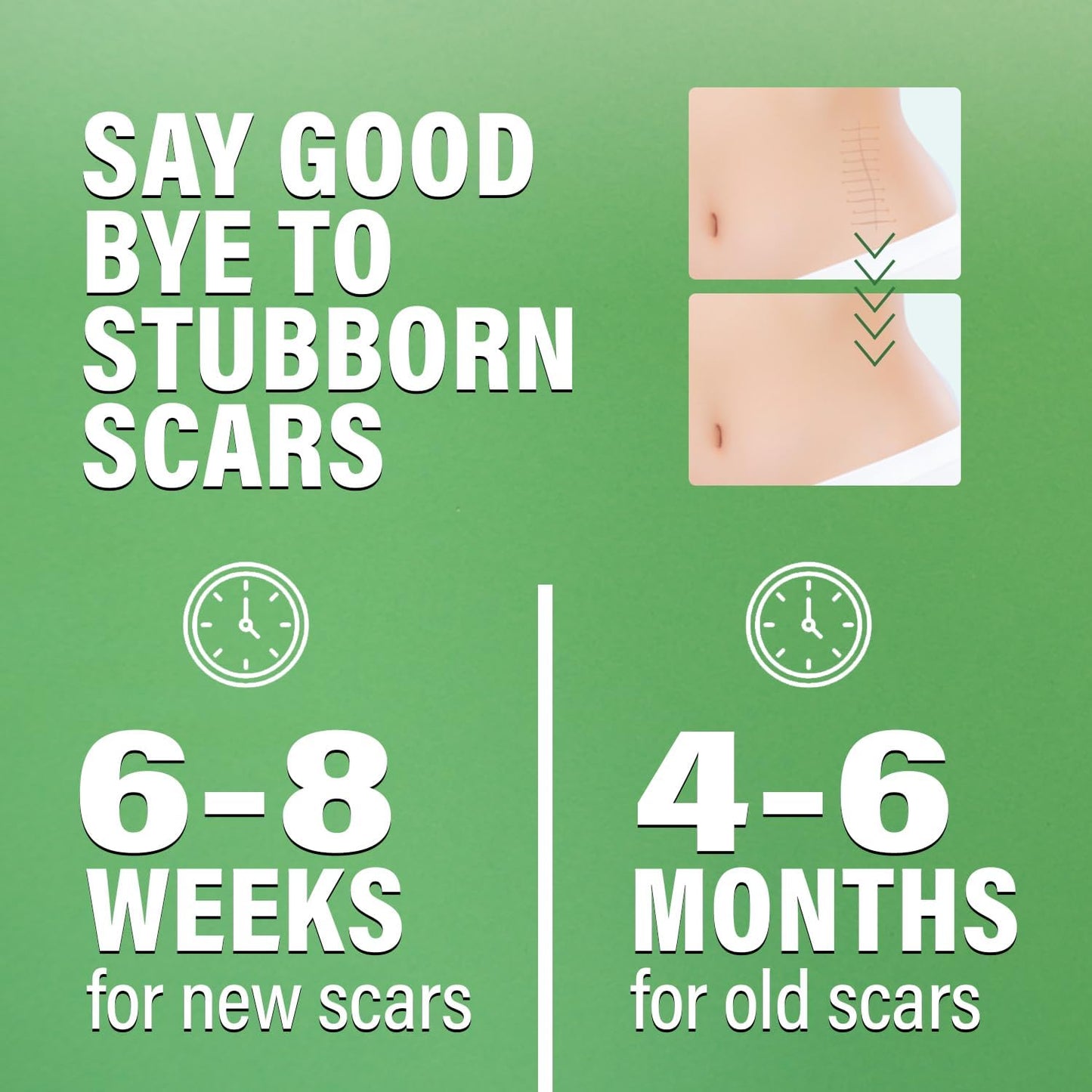Silicone Scar Tape 4cm x 1.5m - Medical Grade Scar Tape for Surgical Scars - Silicone Scar Sheet Reduces the Appearance of Acne Scars, C-Section Scars, Burn Scars & Scars from Stitches