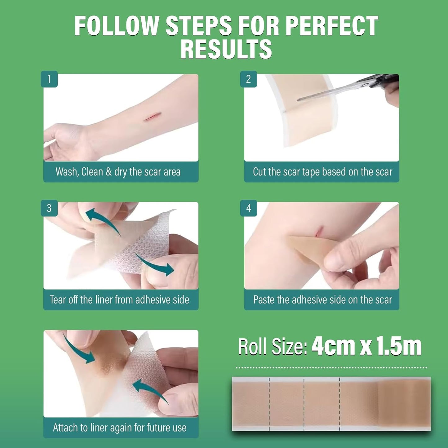 Silicone Scar Tape 4cm x 1.5m - Medical Grade Scar Tape for Surgical Scars - Silicone Scar Sheet Reduces the Appearance of Acne Scars, C-Section Scars, Burn Scars & Scars from Stitches