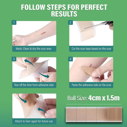 Silicone Scar Tape 4cm x 1.5m - Medical Grade Scar Tape for Surgical Scars - Silicone Scar Sheet Reduces the Appearance of Acne Scars, C-Section Scars, Burn Scars & Scars from Stitches